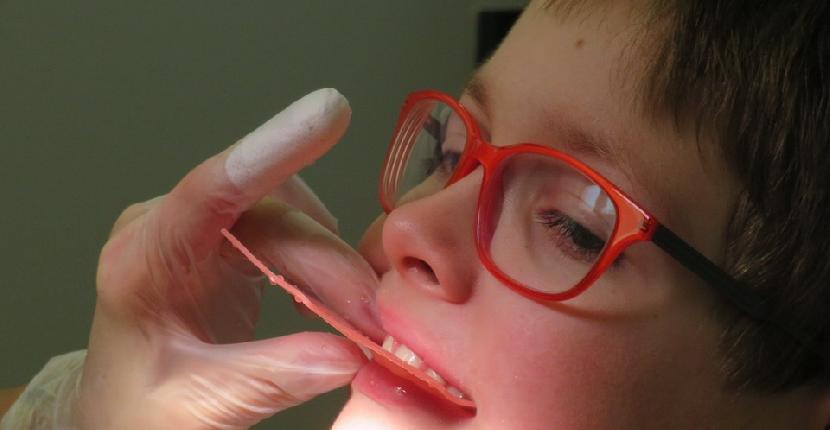 El empleo de la ortodoncia interceptiva en los niños