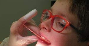 El empleo de la ortodoncia interceptiva en los niños